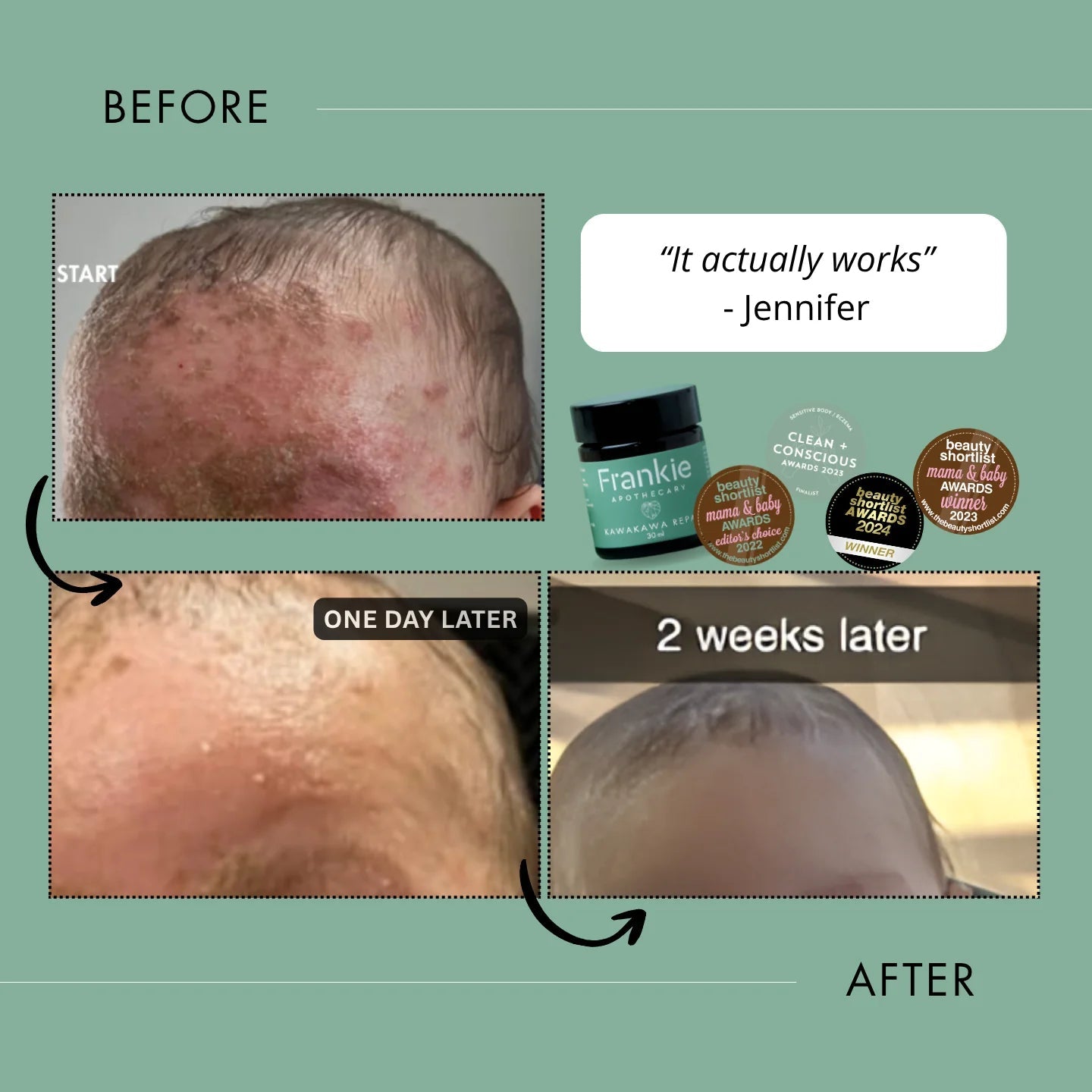 Frankie Apothecary - Kawakawa Repair Balm - The Flower Crate