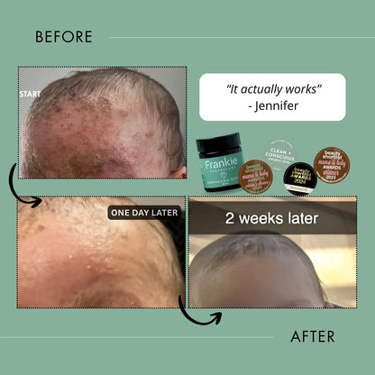 Frankie Apothecary - Kawakawa Repair Balm - The Flower Crate